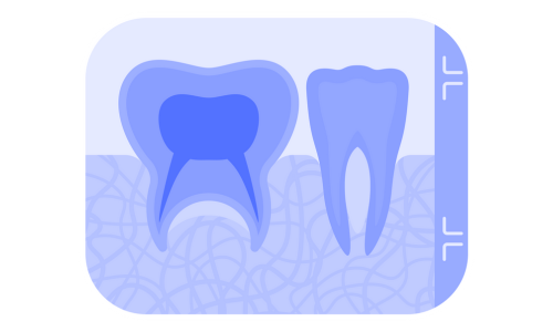RADIOGRAFIAS